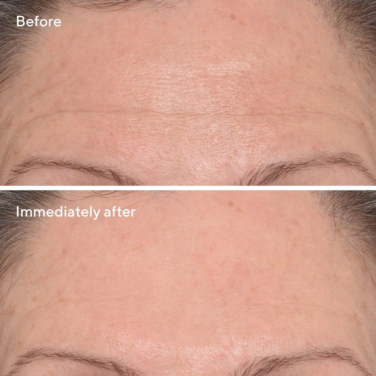 Murad Targeted Wrinkle Corrector علاج مركز لاستهداف التجاعيد والخطوط الدقيقة