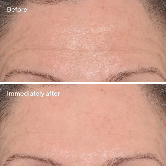 Murad Targeted Wrinkle Corrector علاج مركز لاستهداف التجاعيد والخطوط الدقيقة