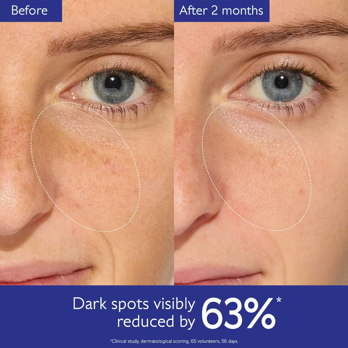 CAUDALIE Brightening Routine for Dark Spots and Uneven Skin Tone روتين التفتيح للتصبغات وتوحيد لون البشرة