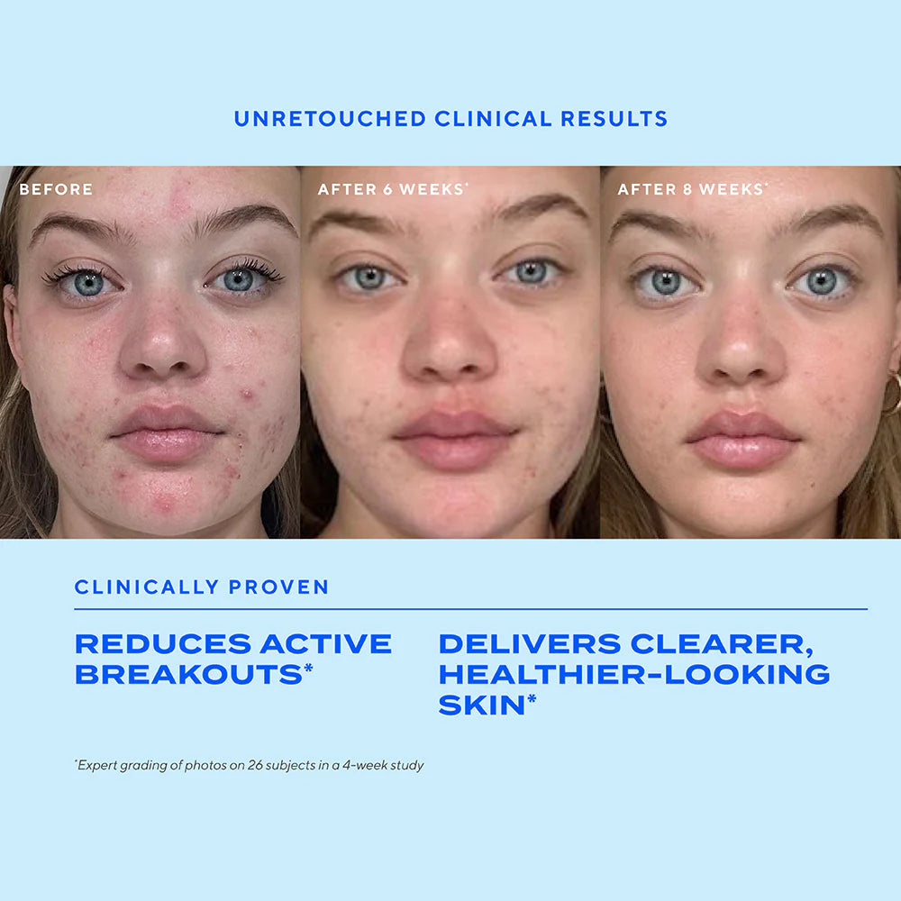 Murad Biome-Balancing Clear & Prevent Acne Treatment Serum سيروم لعلاج الحبوب ومنع ظهورها مع دعم توازن ميكروبيوم البشرة