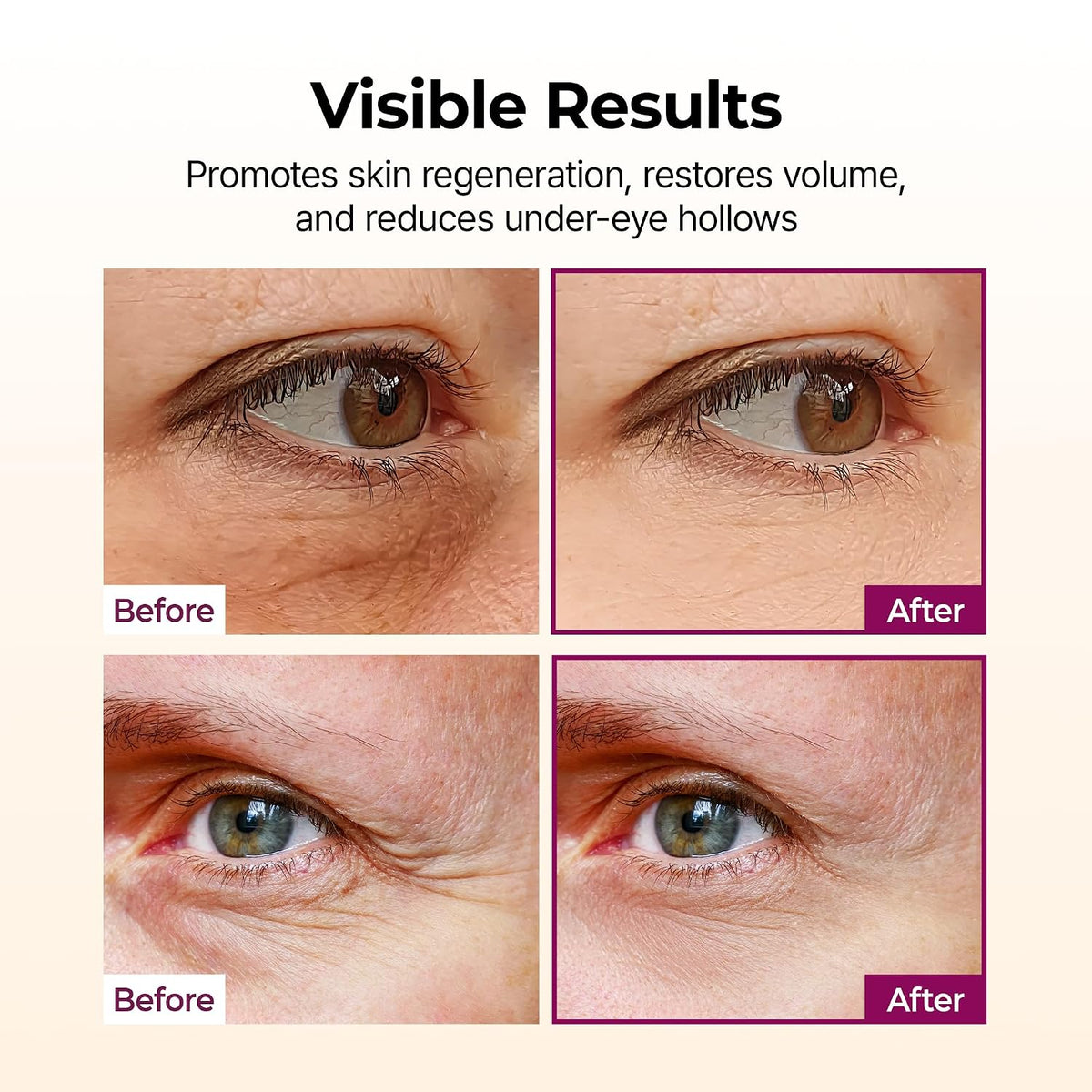 Dr.Melaxin Collagen Multi Balm Stick, Calcium & Adenosine Korean Wrinkle Stick for Eye, Neck & Face, Firming - image 2