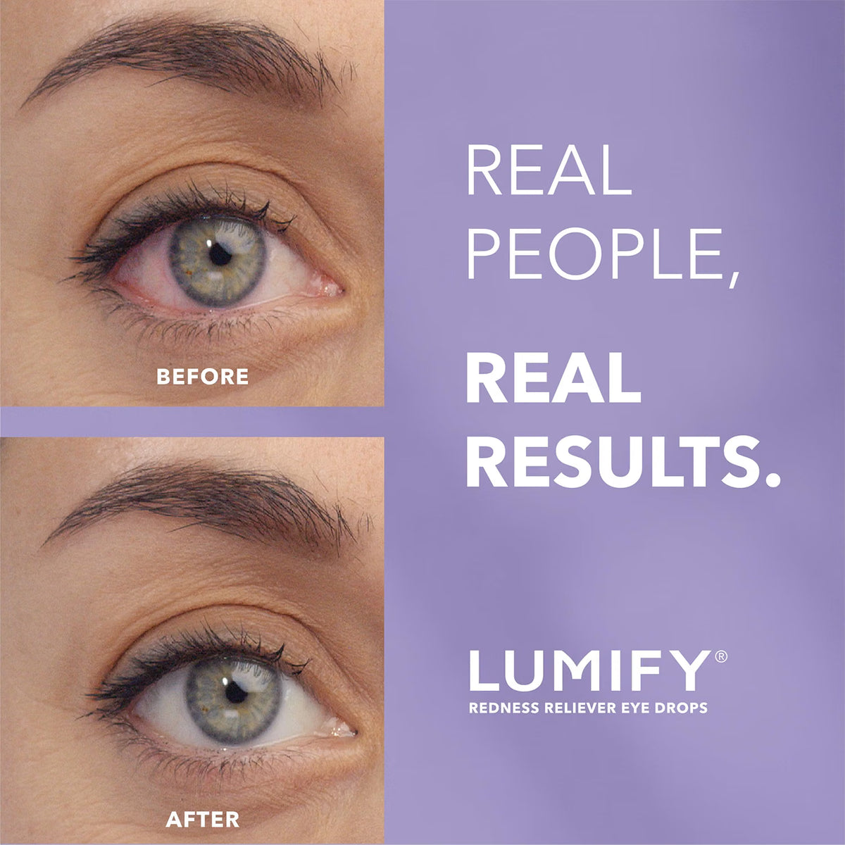 Lumify Redness Relief Eye Drops, Whiter & Brighter Looking Eyes