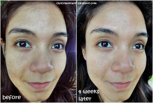 Kiehls Precision Lifting & Pore-Tightening Concentrate سيروم تقليص المسام وشد البشرة
