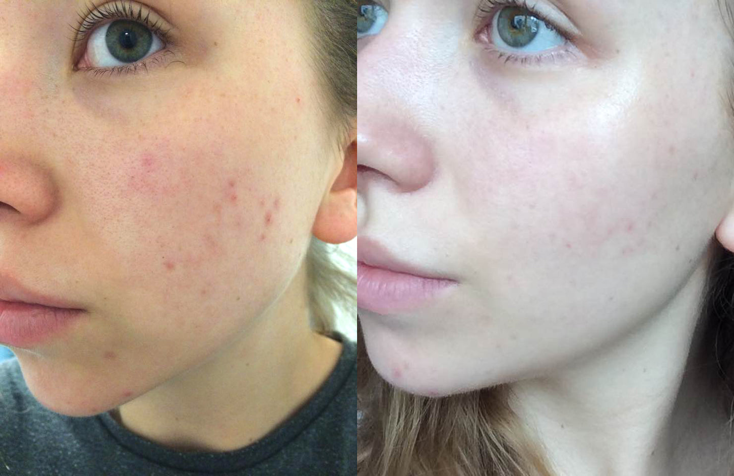 CLINIQUE Radical Dark Spot Corrector + Interrupter سيروم كلينيك للبقع الداكنة