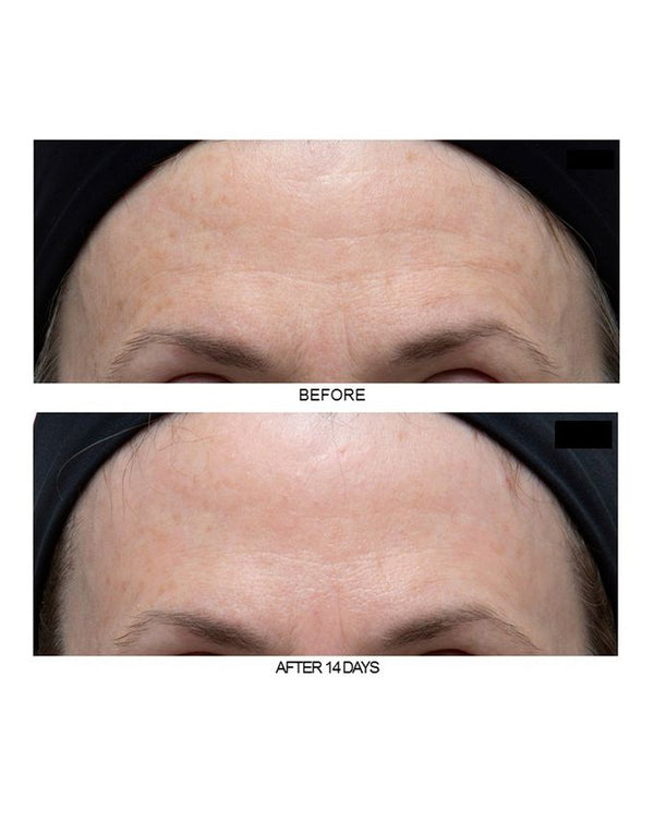 Ferulic + Retinol Wrinkle Recovery Peel 16 treatments