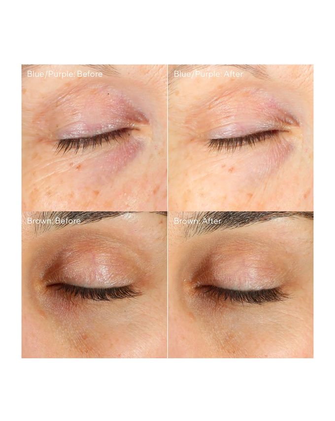 Vita-C Eyes Dark Circle Corrector( 15ml )