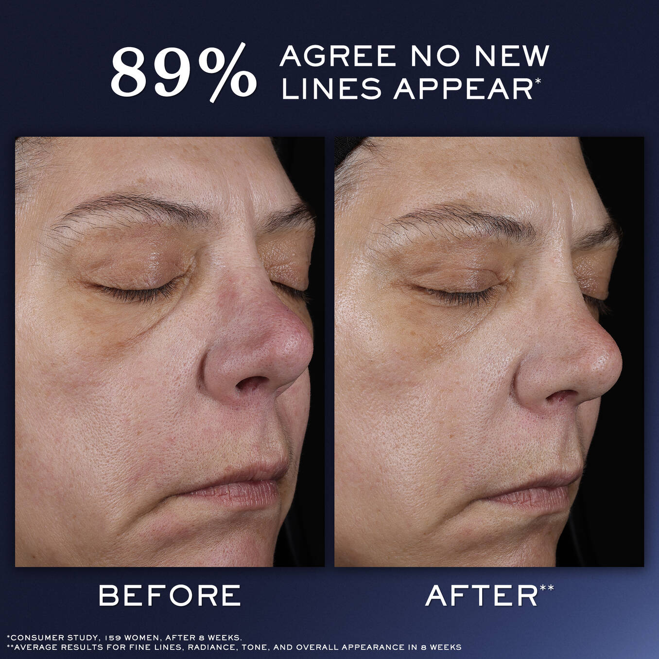 Lancôme Génifique Ultimate Recovery Serum سيروم جينيفيك ألتيميت لإصلاح البشرة واستعادة حاجزها 20 mL