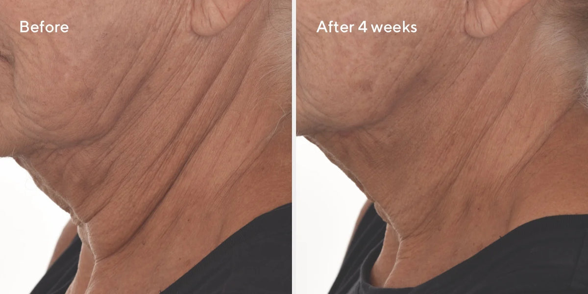 Murad Retinal Face + Eye Firm Up Bundle