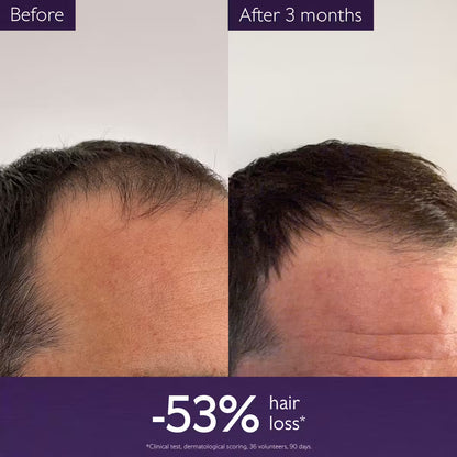 Caudalie Haircare Anti-Hair Loss Serum سيروم تساقط الشعر