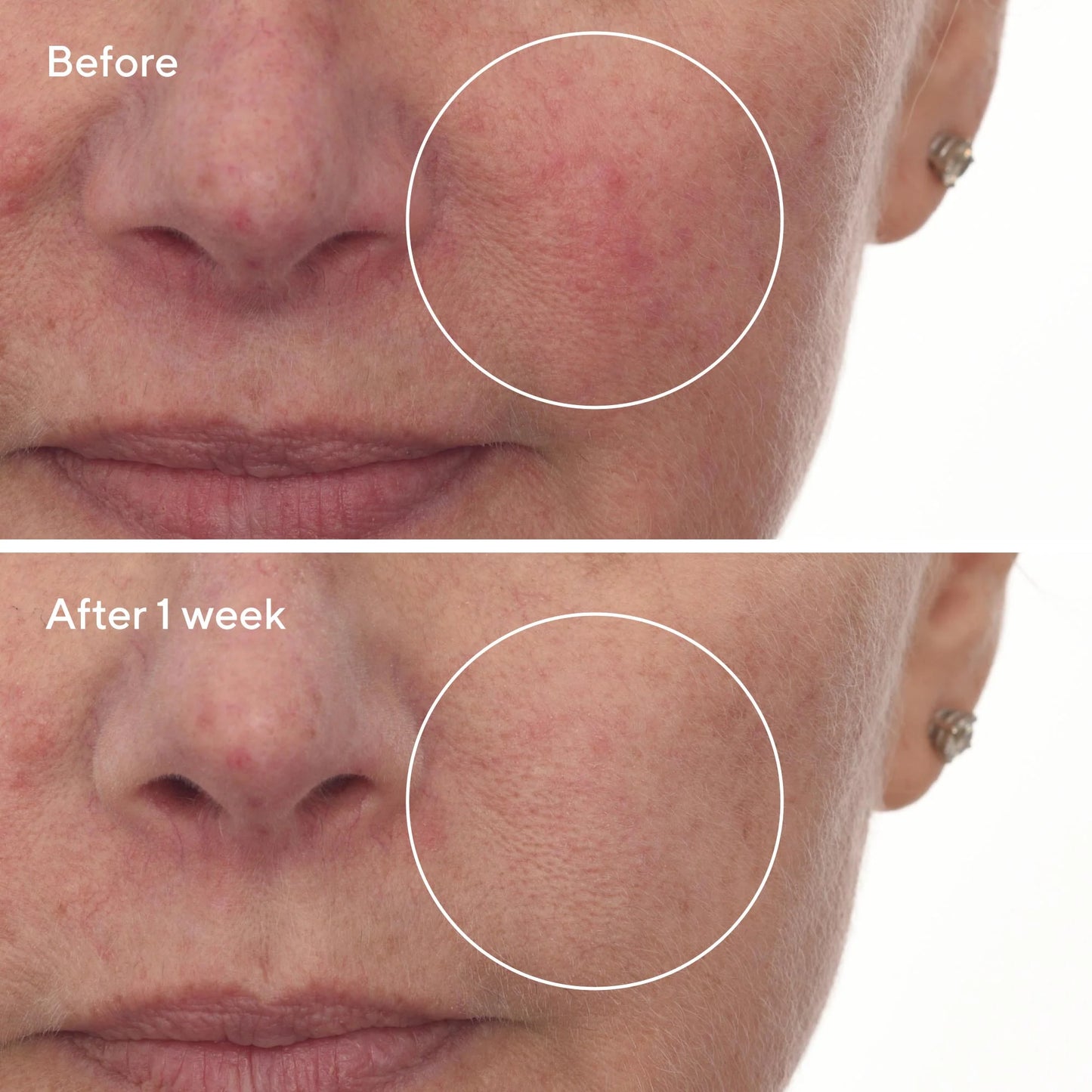 Murad Cellular Hydration Barrier Repair Serum سيروم إصلاح حاجز البشرة وترطيبها على المستوى الخلوي