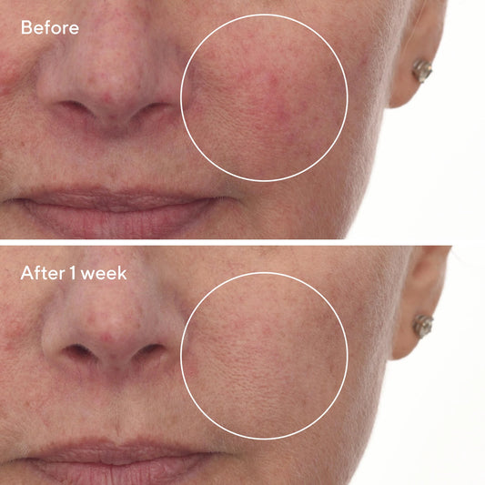 Murad Cellular Hydration Barrier Repair Serum سيروم إصلاح حاجز البشرة وترطيبها على المستوى الخلوي