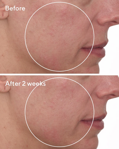 Murad Cellular Hydration Barrier Repair Cream Moisturizer كريم ترطيب وإصلاح حاجز البشرة الخلوي
