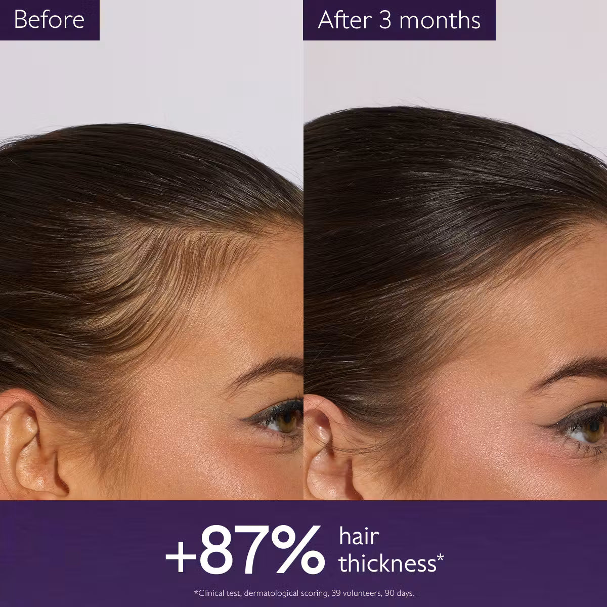 Caudalie Haircare Anti-Hair Loss Serum سيروم تساقط الشعر