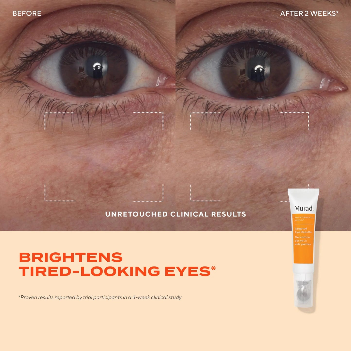 Murad Targeted Eye Depuffer جل مخصص لتقليل انتفاخ تحت العين وشد المنطقة