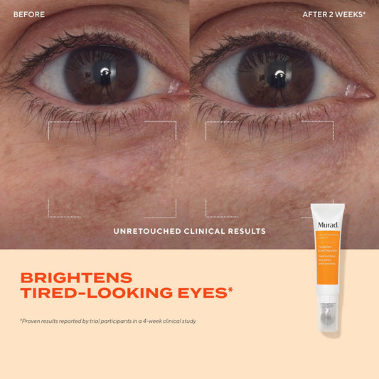 Murad Targeted Eye Depuffer جل مخصص لتقليل انتفاخ تحت العين وشد المنطقة