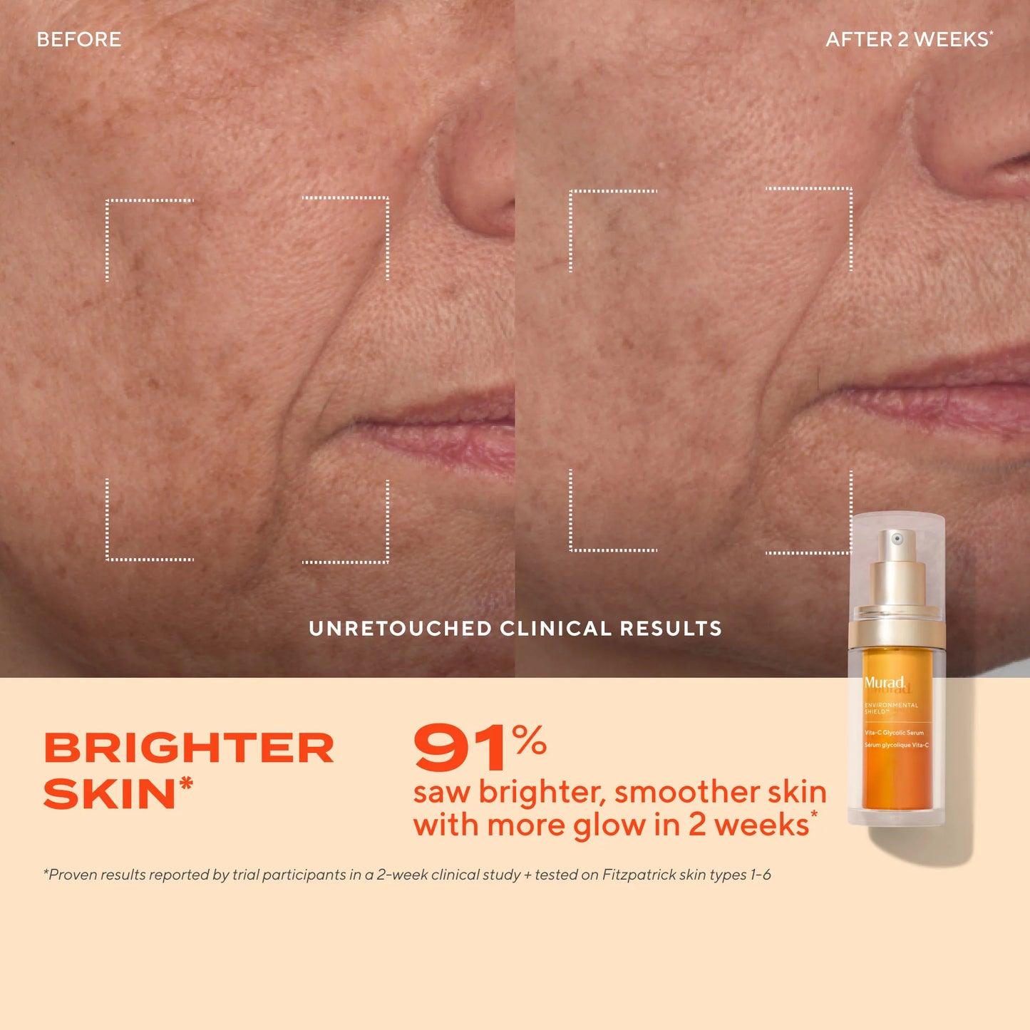 Murad Glow Better Brightening Discovery Kit مجموعة اكتشاف لتفتيح البشرة وتعزيز الإشراقة