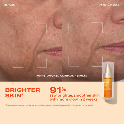 Murad Glow Better Brightening Discovery Kit مجموعة اكتشاف لتفتيح البشرة وتعزيز الإشراقة