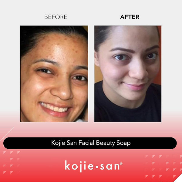 Kojie San Skin Lightening Kojic Acid Soap صابونة تفتيح البشرة والجسم