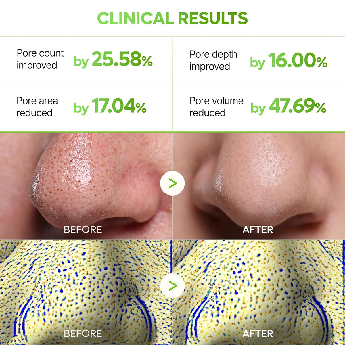 Dr.Melaxin CACTOX 3-STEP NOSE MASK PACK with AHA & PHA for Sebum Softening Pore Tightening Skin Repair - image 2