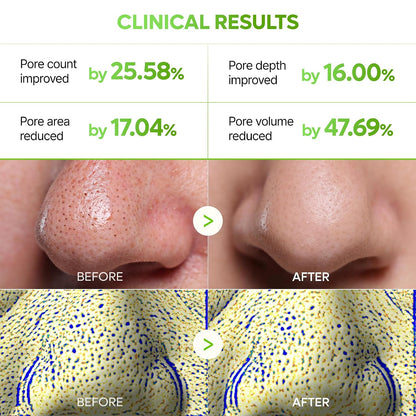 Dr.Melaxin CACTOX 3-STEP NOSE MASK PACK with AHA & PHA for Sebum Softening Pore Tightening Skin Repair - image 2