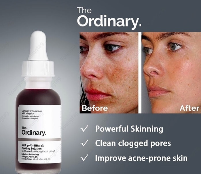 The Ordinary AHA 30% + BHA 2% Peeling Solution