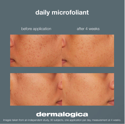 Dermalogica Daily Microfoliant Exfoliater