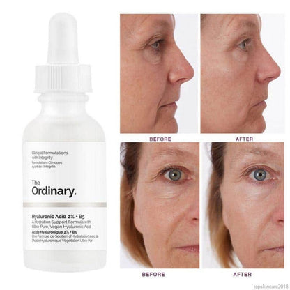 The Ordinary Hyaluronic Acid 2% + B5