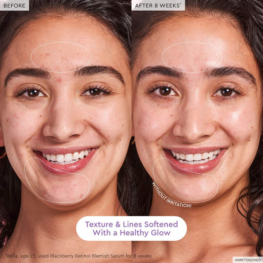 Glow Recipe  Blackberry Retinol Blemish Serum