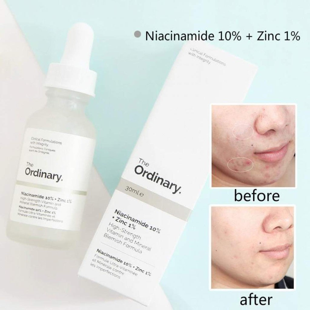 The Ordinary Niacinamide 10% + Zinc 1% | MOLECULES